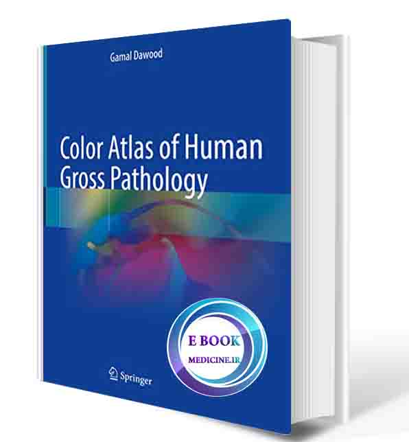 دانلود کتاب Color Atlas of Human Gross Pathology   2022 (ORIGINAL PDF)